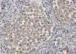 LAMP2 Antibody in Immunohistochemistry (Paraffin) (IHC (P))