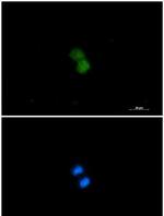 KAT7 Recombinant Rabbit Monoclonal Antibody