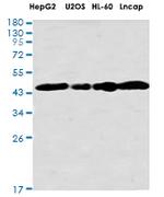 IQGAP2 Antibody in Western Blot (WB)