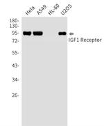 IGF1R Recombinant Rabbit Monoclonal Antibody