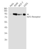 IGF1R Recombinant Rabbit Monoclonal Antibody
