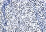 HMGB2 Recombinant Rabbit Monoclonal Antibody