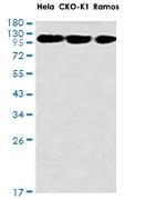 HKDC1 Recombinant Rabbit Monoclonal Antibody