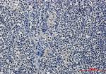 HDAC9 Recombinant Rabbit Monoclonal Antibody