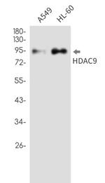 HDAC9 Antibody in Western Blot (WB)