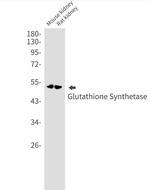 GSS Antibody in Western Blot (WB)
