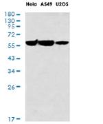 G6PD Antibody in Western Blot (WB)
