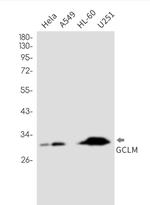 GCLM Antibody in Western Blot (WB)