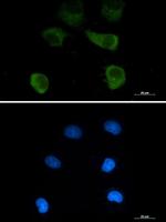 TUBG1 Antibody in Immunocytochemistry (ICC/IF)