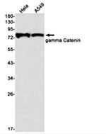 JUP Antibody in Western Blot (WB)