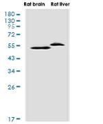 FADS1 Recombinant Rabbit Monoclonal Antibody