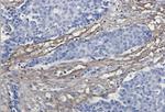 EFEMP1 Recombinant Rabbit Monoclonal Antibody