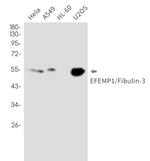 EFEMP1 Antibody in Western Blot (WB)
