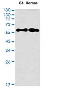 KRT9 Antibody in Western Blot (WB)