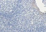 CLIP1 Antibody in Immunohistochemistry (Paraffin) (IHC (P))