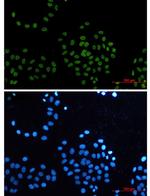 CDK9 Antibody in Immunocytochemistry (ICC/IF)