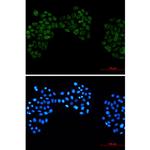 CSNK2B Recombinant Rabbit Monoclonal Antibody