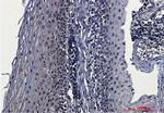 CSNK2B Antibody in Immunohistochemistry (Paraffin) (IHC (P))