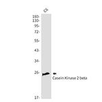 CSNK2B Antibody in Western Blot (WB)