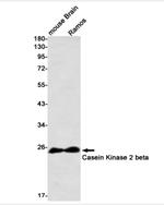 CSNK2B Antibody in Western Blot (WB)