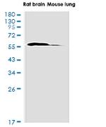 PPP3CA Recombinant Rabbit Monoclonal Antibody