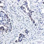 BUB1B Recombinant Rabbit Monoclonal Antibody