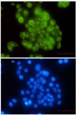 BUB1B Antibody in Immunocytochemistry (ICC/IF)