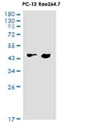 BCKDK Recombinant Rabbit Monoclonal Antibody