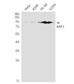 BAP1 Recombinant Rabbit Monoclonal Antibody