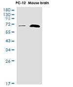 ATP6V1A Antibody in Western Blot (WB)