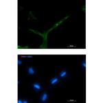 APC Recombinant Rabbit Monoclonal Antibody