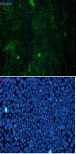 CTTN Recombinant Rabbit Monoclonal Antibody