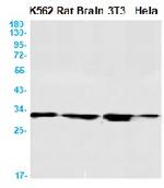 CLPP Recombinant Rabbit Monoclonal Antibody
