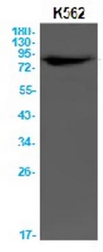 PARP1 Antibody in Western Blot (WB)