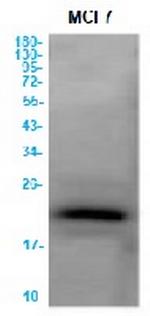 CLDN3 Recombinant Rabbit Monoclonal Antibody
