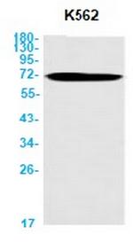 BIRC2 Antibody in Western Blot (WB)