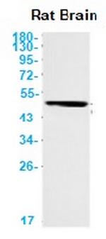CHAT Antibody in Western Blot (WB)