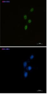 CHEK2 Recombinant Rabbit Monoclonal Antibody
