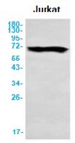 CHEK2 Antibody in Western Blot (WB)