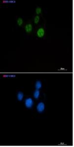 CHEK2 Recombinant Rabbit Monoclonal Antibody