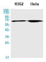 CHEK2 Antibody in Western Blot (WB)
