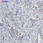 DTL Recombinant Rabbit Monoclonal Antibody