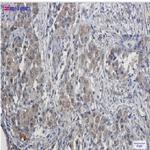 CDK4 Recombinant Rabbit Monoclonal Antibody