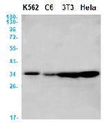 CDK4 Antibody in Western Blot (WB)