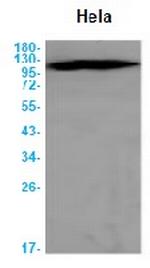 CBL Antibody in Western Blot (WB)