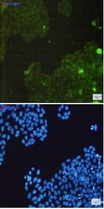 CAT Recombinant Rabbit Monoclonal Antibody