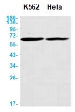 CAT Antibody in Western Blot (WB)