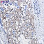 CAT Antibody in Immunohistochemistry (Paraffin) (IHC (P))
