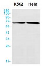CAT Antibody in Western Blot (WB)