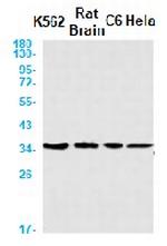 CSNK1A1 Recombinant Rabbit Monoclonal Antibody